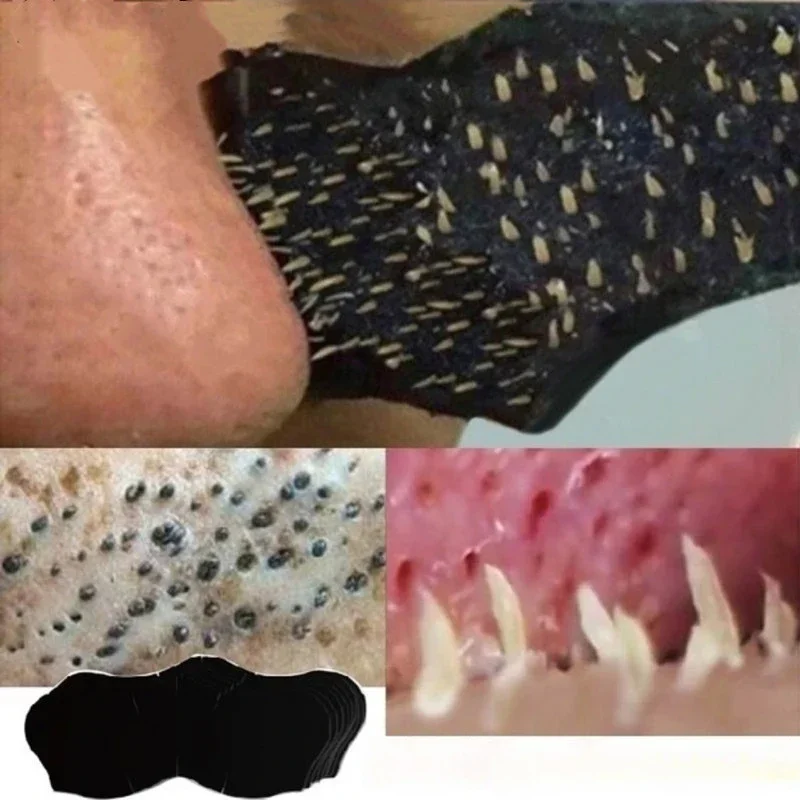 Skincare Viral Tiktok - 10PC/50 PC100 PC Siyah Nokta Burun