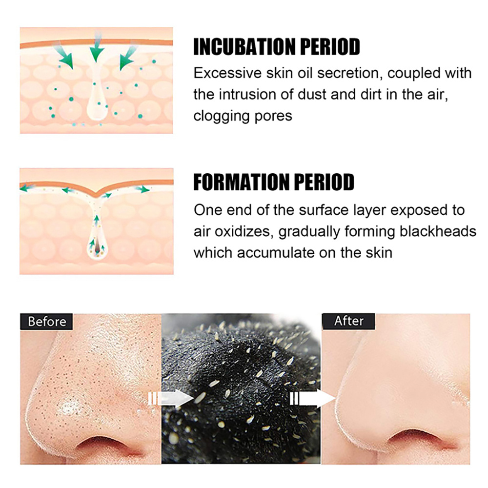 10/20/50/100 adet burun siyah  - Skincare Viral Tiktok incelemesi ve fiyatı